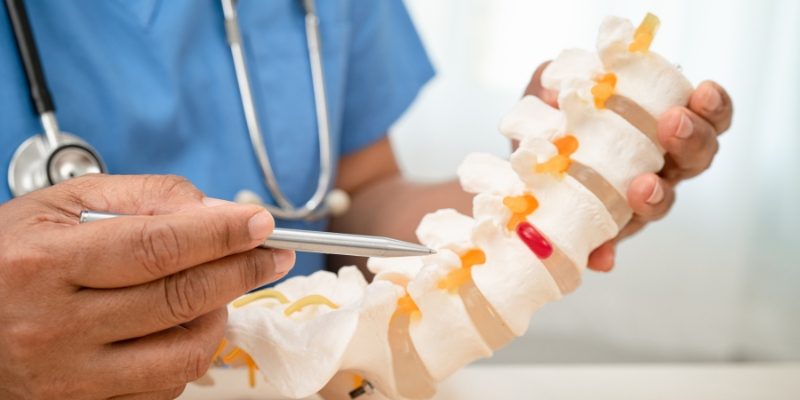 Ankylosing spondylitis_ Ankylosing spondylitis_
